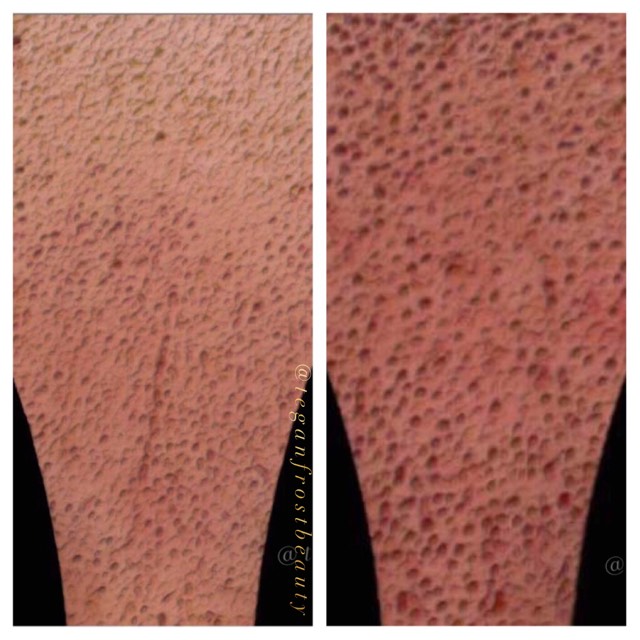 Difference Between Oily And Dry Skin